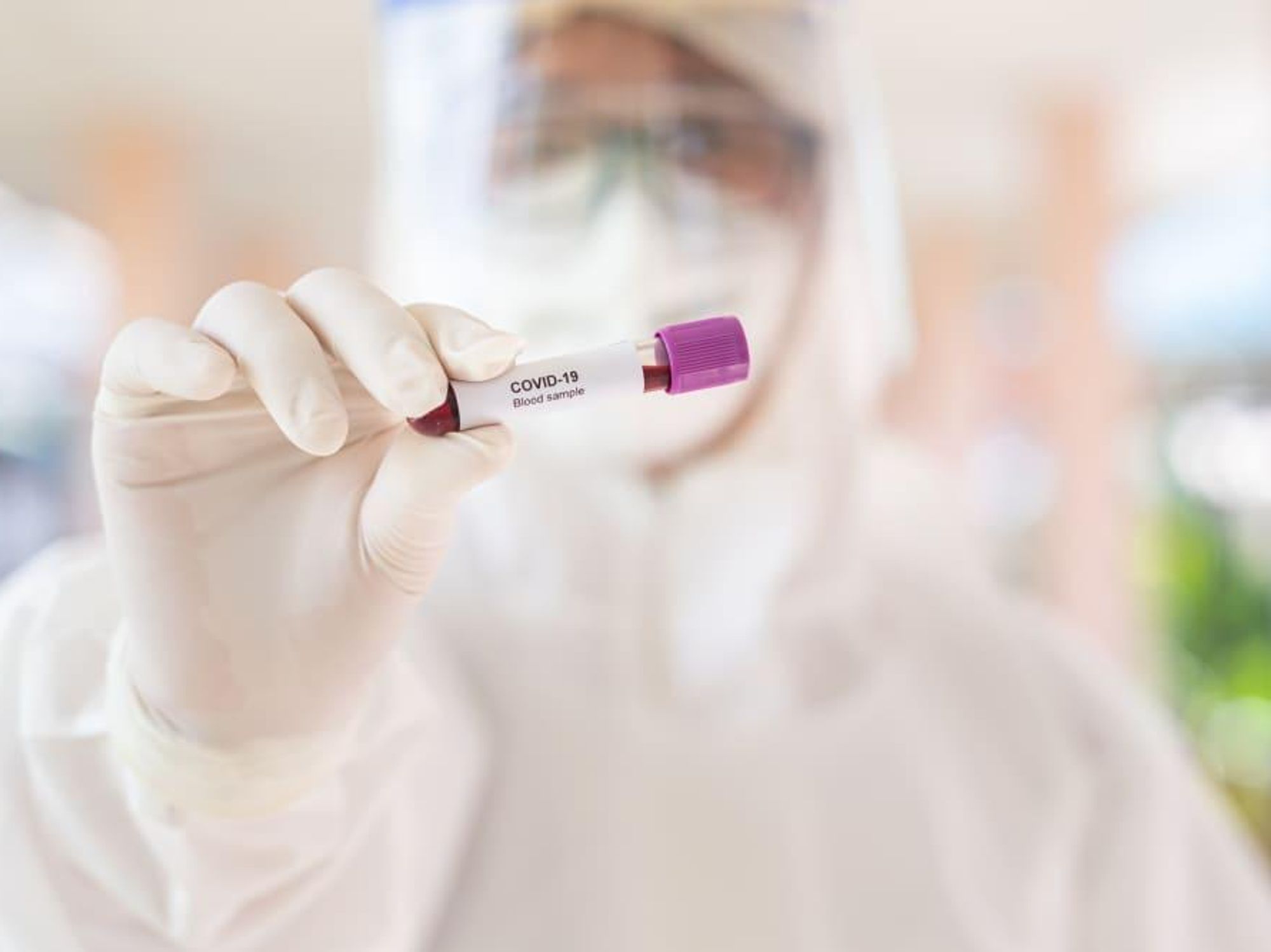 Coronavirus testing COVID-19 testing lab doctor test