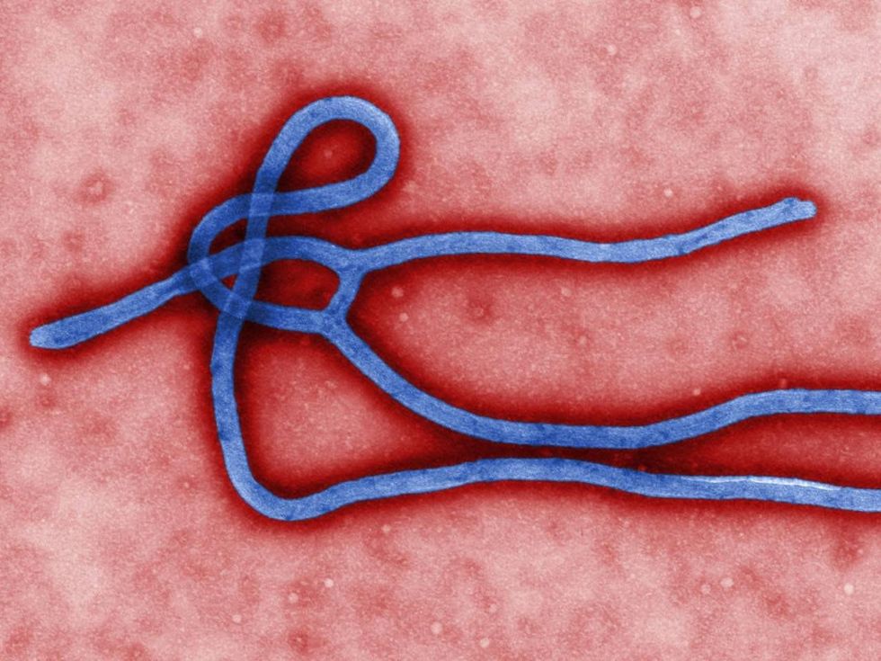 Ebola virus