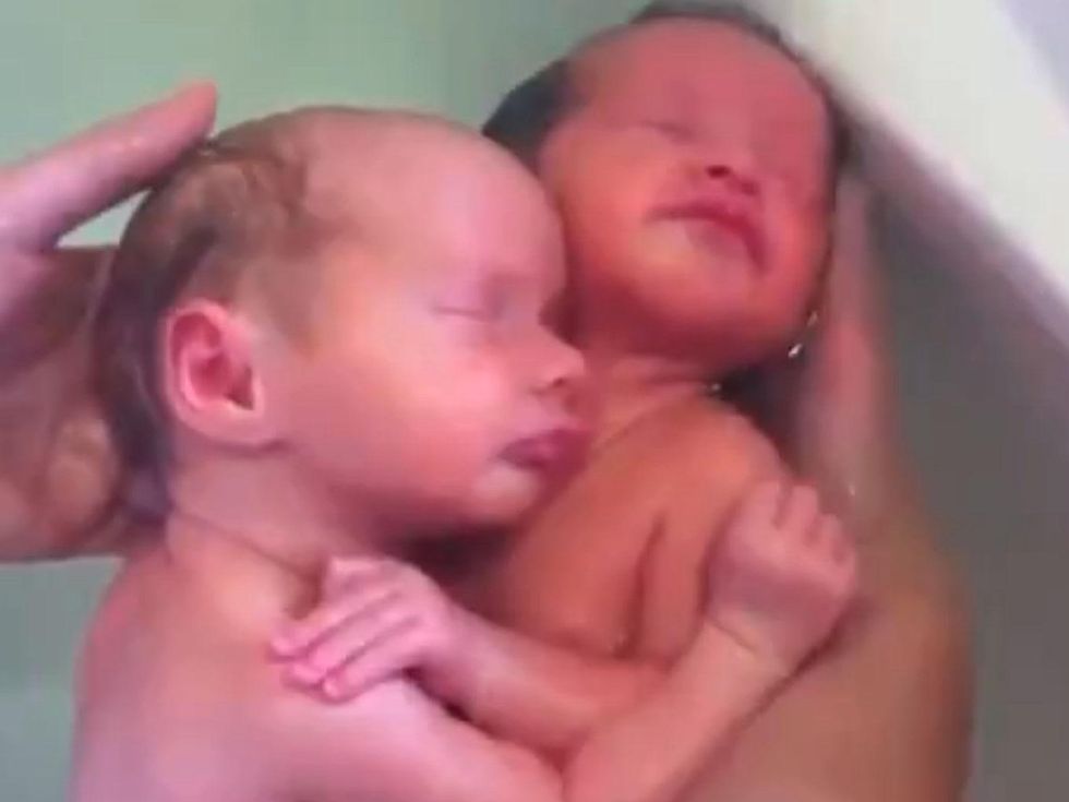 Twins don't realize they've been born
